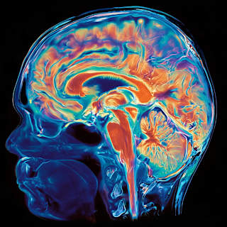 Human Brain Is Two Fused Organs
